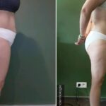 Endermologie - Avant/Après 16