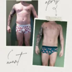 L'endermologie par Sophie_9